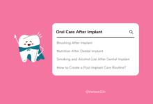 how-should-oral-care-be-after-dental-implants
